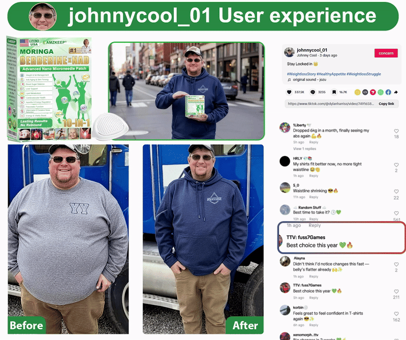⏰Just Today🇺🇸𝙰𝙼𝚉𝙺𝙴𝙴𝙿® 𝙈𝒐𝒓𝒊𝒏𝒈𝗮 · 𝗕𝗲𝗿𝗯𝐞𝐫𝐢𝐧𝙚 × 𝙉𝑨𝑫+ 𝟏𝟎-𝙞𝙣-𝟏 𝘼𝒅𝒗𝒂𝒏𝒄𝒆𝐝 𝐍𝐚𝐧𝙤 𝙈𝙞𝙘𝙧𝙤𝙣𝒆𝒆𝒅𝒍𝐞 𝐏𝐚𝐭𝙘𝙝(𝐉𝐮𝐬𝐭 𝐨𝐧𝐜𝐞 𝐚 𝐝𝐚𝐲, 𝐯𝐢𝐬𝐢𝐛𝐥𝐞 𝐜𝐡𝐚𝐧𝐠𝐞𝐬 𝐢𝐧 𝟕 𝐝𝐚𝐲𝐬） ✅ 𝐅𝐨𝐫 𝐨𝐛𝐞𝐬𝐢𝐭𝐲, 🅛🅞🅞🅢🅔 🅢🅚🅘🅝,𝐝𝐢𝐚𝐛𝐞𝐭𝐞𝐬, 𝐬𝐥𝐞𝐞𝐩 𝐚𝐩𝐧𝐞𝐚, 𝐣𝐨𝐢𝐧𝐭 𝐢𝐬𝐬𝐮𝐞𝐬, 𝐚𝐧𝐝 𝐦𝐨𝐫𝐞